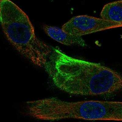 Immunocytochemistry/ Immunofluorescence: IQUB Antibody [NBP2-33573]