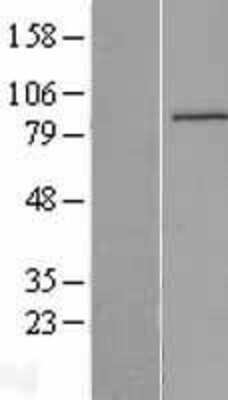 Western Blot: IQUB Overexpression Lysate [NBP2-04944]