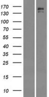 Western Blot: INSRR/IR-related receptor Overexpression Lysate [NBP2-10334]