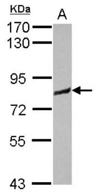 Western Blot: IRAG Antibody [NBP2-16987]