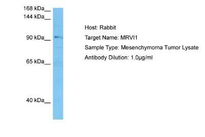 Western Blot: IRAG Antibody [NBP2-85104]