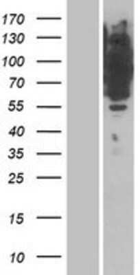 Western Blot: IRAG Overexpression Lysate [NBP2-10910]