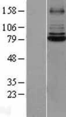 Western Blot: IRAK1 Overexpression Lysate [NBL1-12025]