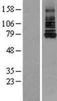 Western Blot: IRAK1 Overexpression Lysate [NBL1-12026]