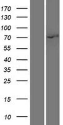 Western Blot: IRAK1 Overexpression Lysate [NBP2-11046]