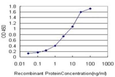 ELISA: IRAK1 Antibody (3A9) [H00003654-M02]