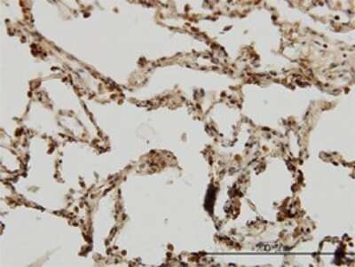 Immunohistochemistry-Paraffin: IRAK1 Antibody (3A9) [H00003654-M02]