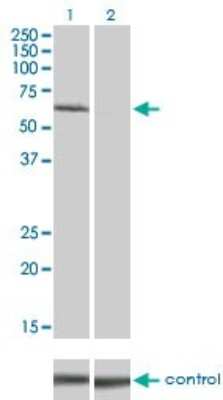 Western Blot: IRAK1 Antibody (3A9) [H00003654-M02]