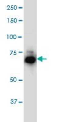 Western Blot: IRAK1 Antibody (3A9) [H00003654-M02]