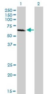 Western Blot: IRAK1 Antibody (3A9) [H00003654-M02]