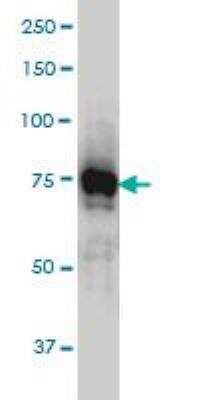 Western Blot: IRAK1 Antibody (3F7) [H00003654-M01]
