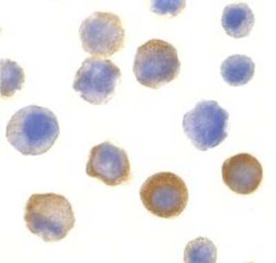 Immunocytochemistry/ Immunofluorescence: IRAK1 Antibody - BSA Free [NBP1-77068]