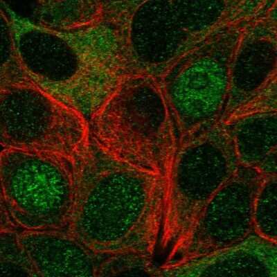 Immunocytochemistry/ Immunofluorescence: IRAK1 Antibody [NBP2-38726]