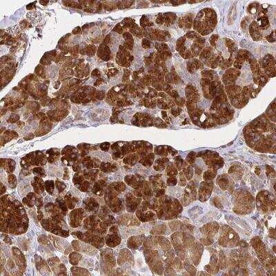 Immunohistochemistry-Paraffin: IRAK1 Antibody [NBP2-38726]