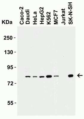 Western Blot: IRAK1 AntibodyBSA Free [NBP1-77068]