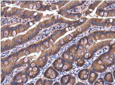 Immunohistochemistry-Paraffin: IRAK1BP1 Antibody [NBP1-31863]