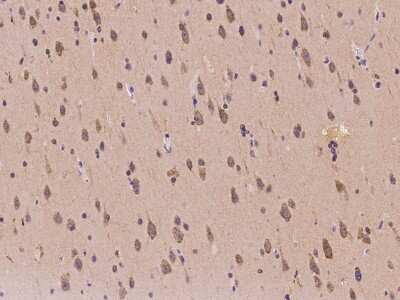 Immunohistochemistry-Paraffin: IRAK1BP1 Antibody [NBP2-97199]