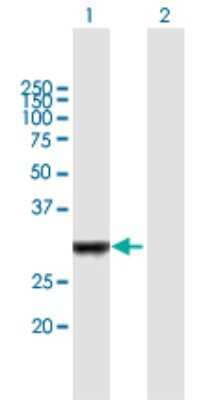 Western Blot: IRAK1BP1 Antibody [H00134728-B01P]