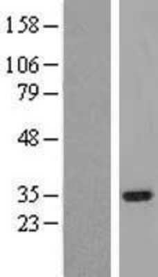 Western Blot: IRAK1BP1 Overexpression Lysate [NBP2-08760]