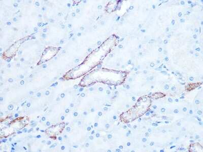 Immunohistochemistry-Paraffin: IRAK2 Antibody (10G3F8) [NBP3-16457]