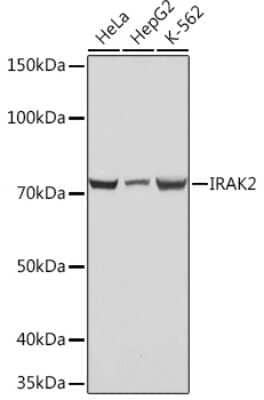 Western Blot: IRAK2 Antibody (10G3F8) [NBP3-16457]