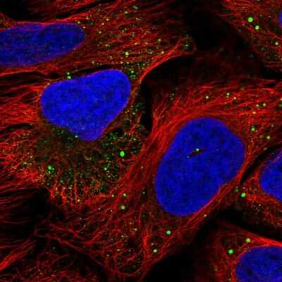 Immunocytochemistry/ Immunofluorescence: IRAK2 Antibody [NBP2-38629]