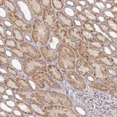 Immunohistochemistry: IRAK2 Antibody [NBP2-38629]