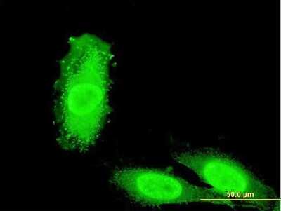 Immunocytochemistry/ Immunofluorescence: IRAK3 Antibody (1C8) [H00011213-M06]