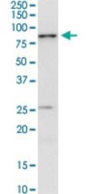 Western Blot: IRAK3 Antibody (1C9) [H00011213-M07]