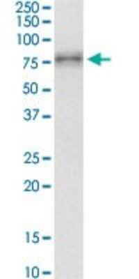 Western Blot: IRAK3 Antibody (1C9) [H00011213-M07]