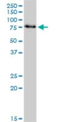 Western Blot: IRAK3 Antibody (1C9) [H00011213-M07]