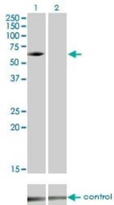 Western Blot: IRAK3 Antibody (1F6) [H00011213-M02]
