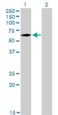 Western Blot: IRAK3 Antibody (1F6) [H00011213-M02]