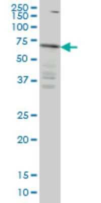 Western Blot: IRAK3 Antibody (1G11) [H00011213-M04]