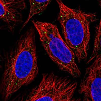 Immunocytochemistry/ Immunofluorescence: IRAK3 Antibody [NBP1-83094]
