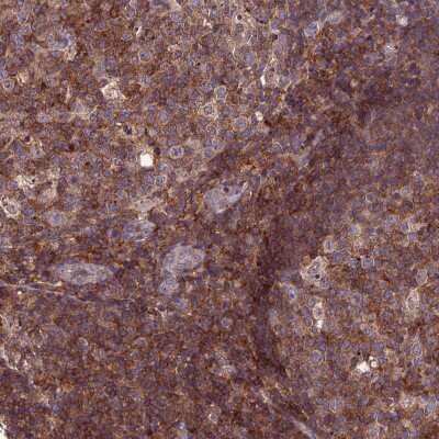 Immunohistochemistry-Paraffin: IRAK3 Antibody [NBP1-83094]