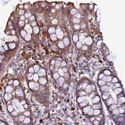 Immunohistochemistry-Paraffin: IRAK3 Antibody [NBP1-83094]