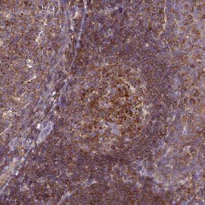 Immunohistochemistry-Paraffin: IRAK3 Antibody [NBP1-83094]
