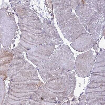 Immunohistochemistry-Paraffin: IRAK3 Antibody [NBP1-83094]