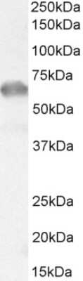 Western Blot: IRAK3 Antibody [NB100-96912]