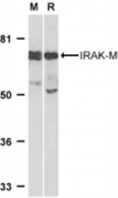 Western Blot: IRAK3 AntibodyBSA Free [NBP1-76782]