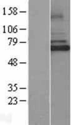 Western Blot: IRAK3 Overexpression Lysate [NBL1-12027]