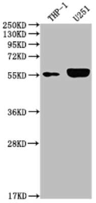 Western Blot: IRAK4 Antibody (10H4) [NBP3-15153]