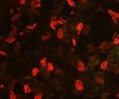 Immunohistochemistry: IRAK4 Antibody (6F8) [DDX0340P-100]