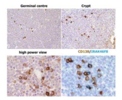 Immunohistochemistry: IRAK4 Antibody (6F8) [DDX0340P-100]