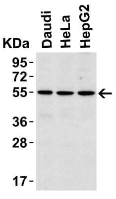 Western Blot: IRAK4 AntibodyBSA Free [NBP1-77231]