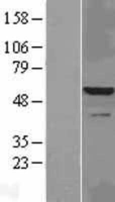 Western Blot: IRAK4 Overexpression Lysate [NBL1-12028]