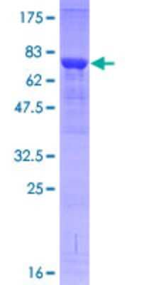 SDS-PAGE: Recombinant Human IRAK4 GST (N-Term) Protein [H00051135-P01]