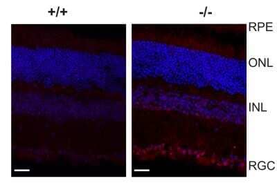 Immunohistochemical Staining of IRE1 alpha in Frozen Mouse Retina