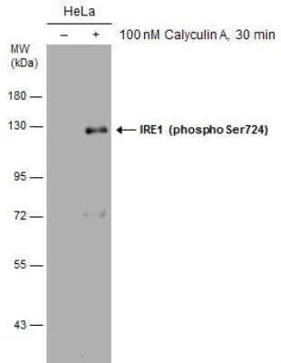 Western Blot: IRE1 alpha [p Ser724] Antibody [NBP3-12123]